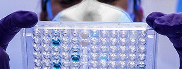 Control analítico y microbiológico de calidad