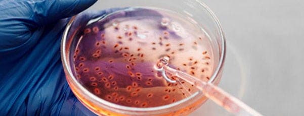 Líneas celulares y cultivo celular