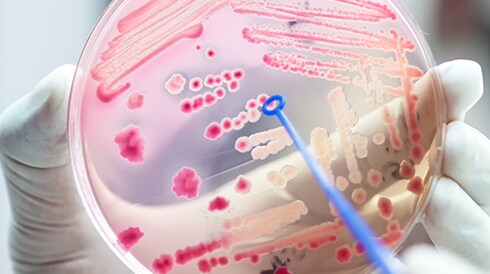 Improving Antimicrobial Resistance Detection