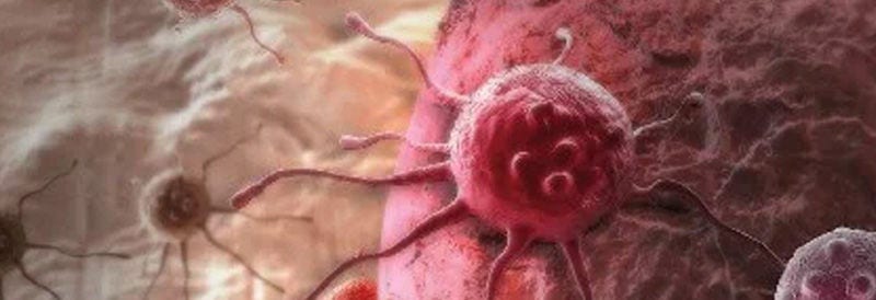 Making Cancer History - CAR T-Cell Therapy