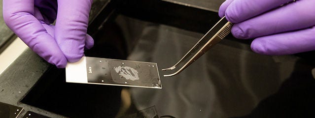 Inmunohistoquímica (IHC)