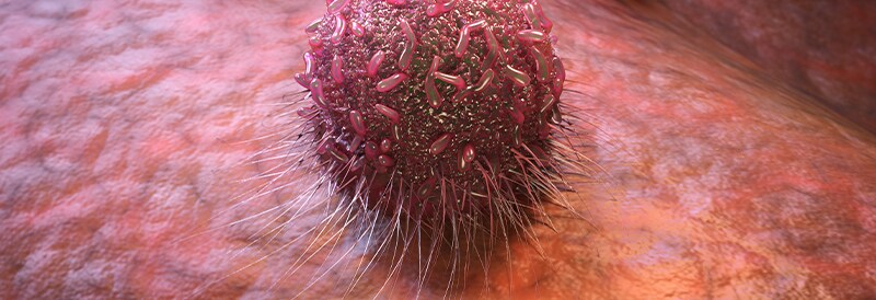 Target Cell Adhesion Limits Macrophage Phagocytosis and Promotes Trogocytosis