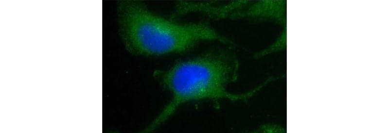 Nestin Rabbit anti-Human, Mouse, Rat, Polyclonal, Proteintech