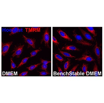 Las células cultivadas en medios BenchStable™ mantienen mitocondrias sanas