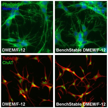 Diferenciación efectiva en células SH-SY5Y cultivadas en medios BenchStable™ Media
