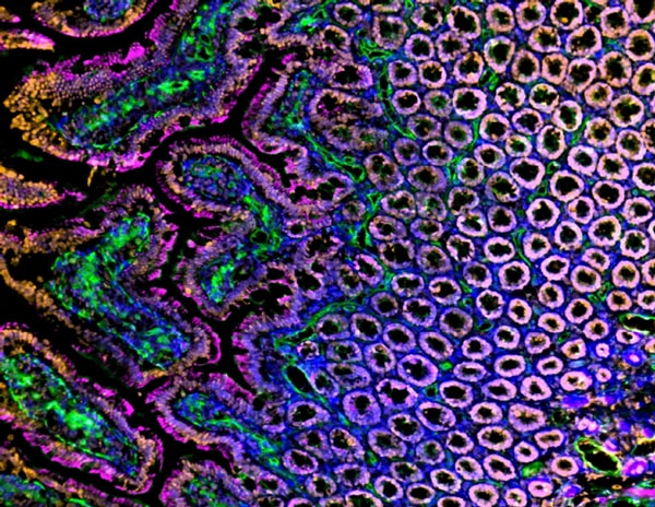 Análisis inmunofluorescente de secciones congeladas de intestino de rata Sprague Dawley, duodeno, con Histona H3 (naranja), vasos sanguíneos (lectina, verde), actina (magenta) y núcleos (azul)