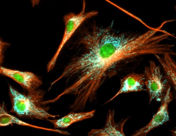 Análisis inmunofluorescente de tubulina en células BPAE con superposiciones de mitocondrias (ATP sintasa, cian), tubulina (naranja) y núcleos (verde)