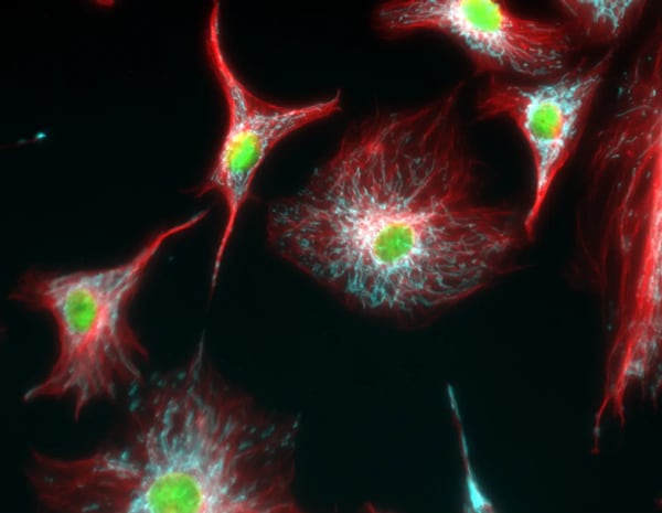 Análisis inmunofluorescente de tubulina en células BPAE con superposiciones de mitocondrias (ATP sintasa, cian), tubulina (rojo) y núcleos (verde)