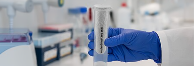 Retos del ADN plasmídico utilizado en aplicaciones biofarmacéuticas y terapia génica 