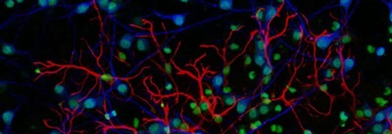 Avances tecnológicos en microscopía de fluorescencia