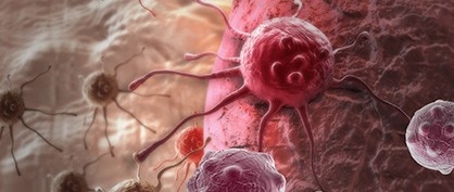 Haciendo historia ena la investigación contra el cáncer: la terapia con células T CAR