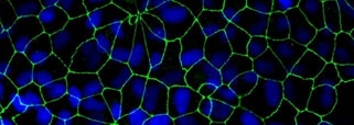 Antibodies